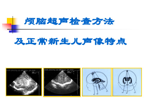 颅脑超声