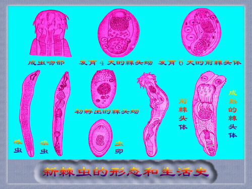 10-5、6棘头虫与鱼蛭病