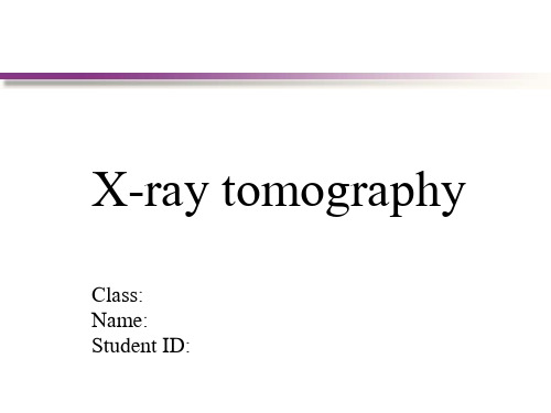 X-ray tomography