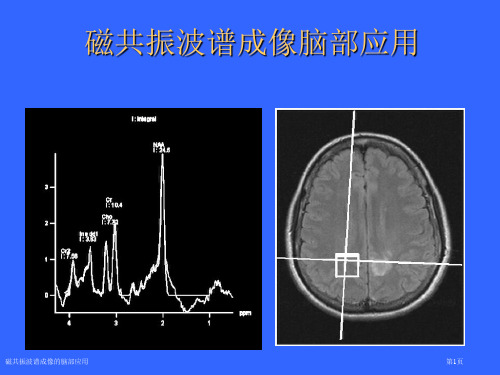 磁共振波谱成像的脑部应用