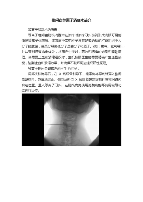 椎间盘等离子消融术简介