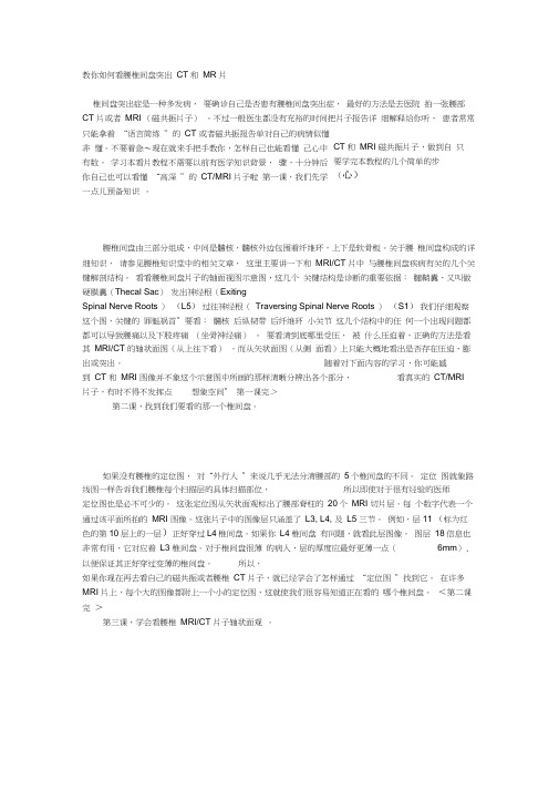 教你如何看腰椎间盘突出CT和MR片