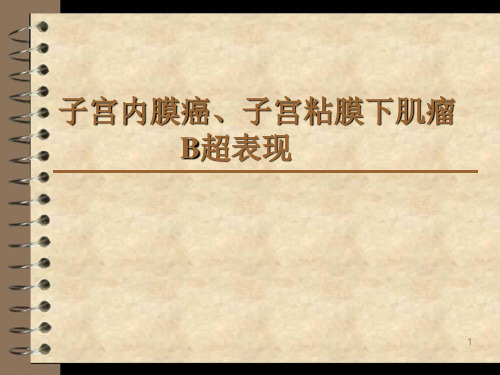 子宫内膜癌、子宫粘膜下肌瘤B超表现PPT演示课件