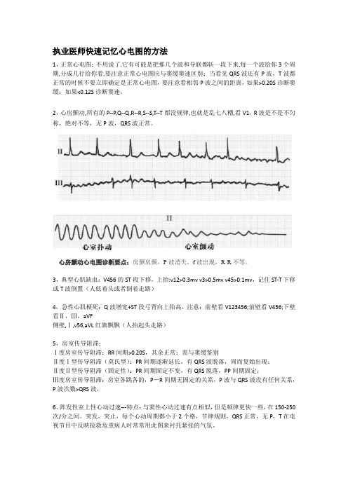 心电图快速记忆的方法