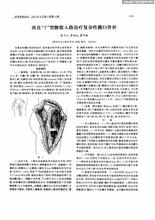 改良“T”型髂股入路治疗复杂性髋臼骨折