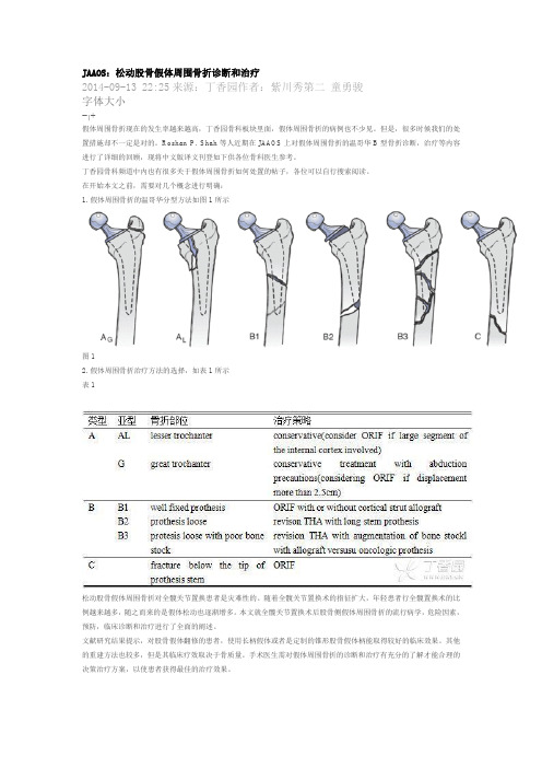 松动股骨假体周围骨折诊断和治疗