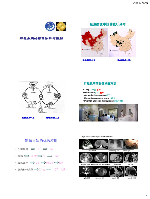 肝包虫病的影像诊断