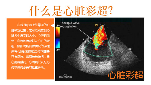 心脏彩超基本概述