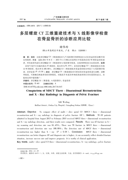 多层螺旋CT三维重建技术与X线影像学检查在骨盆骨折的诊断应用比较