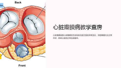 心脏瓣膜病教学查房