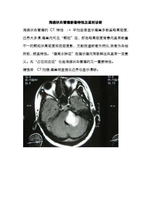 海绵状血管瘤影像特征及鉴别诊断