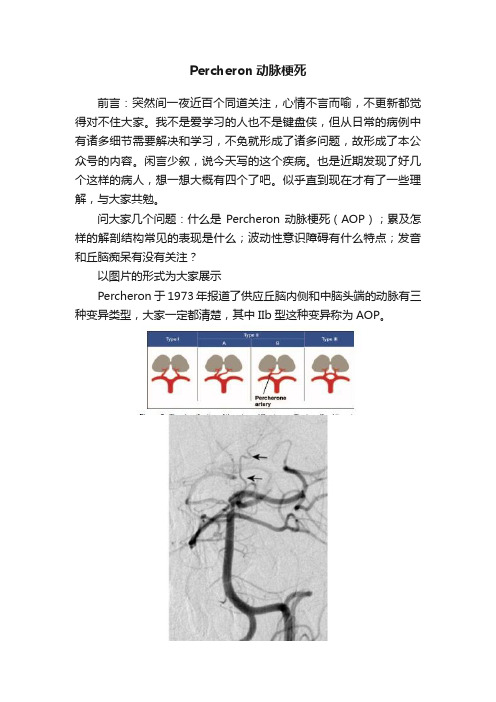 Percheron动脉梗死