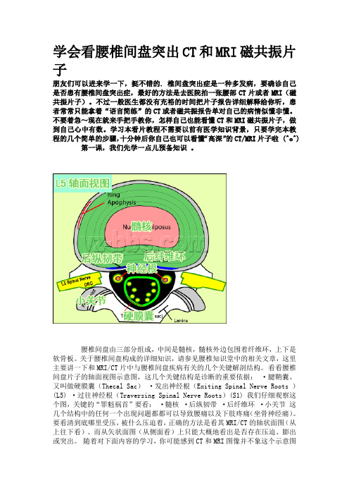 腰椎图片