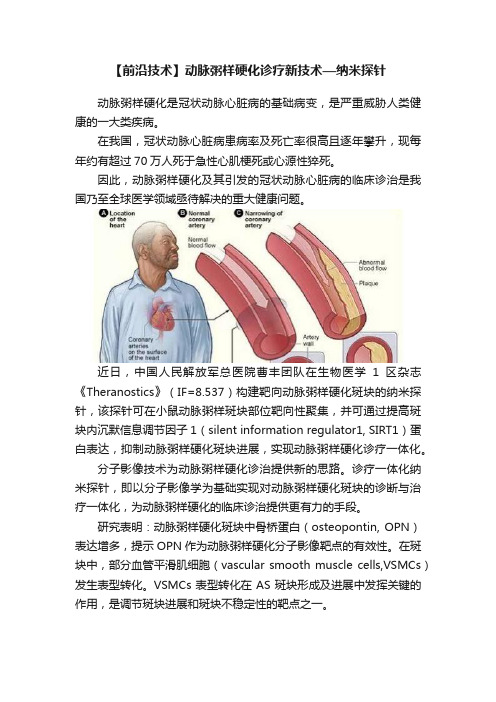 【前沿技术】动脉粥样硬化诊疗新技术—纳米探针