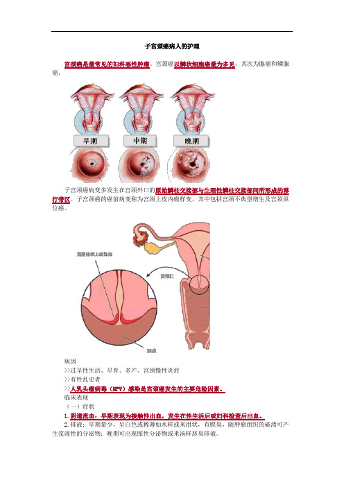 子宫颈癌病人的护理考点总结