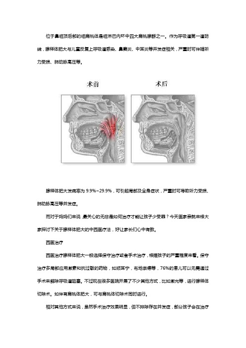 腺样体肥大中医和西医哪个治疗好