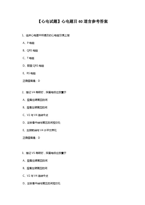 【心电试题】心电题目60道含参考答案