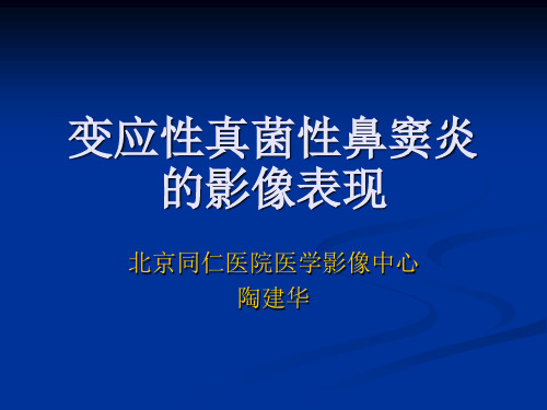 变应性真菌性鼻窦炎的影像表现