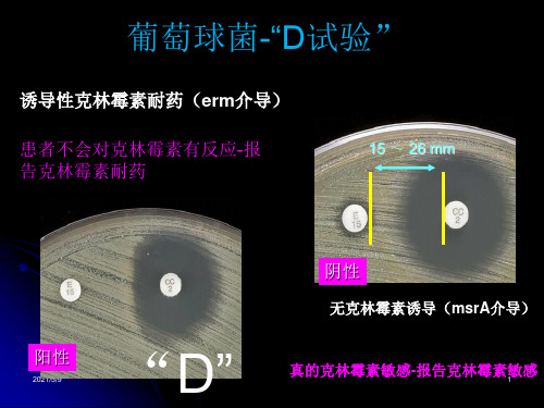 葡萄球菌-“D试验”