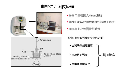 59血栓弹力图临床血液学检验技术