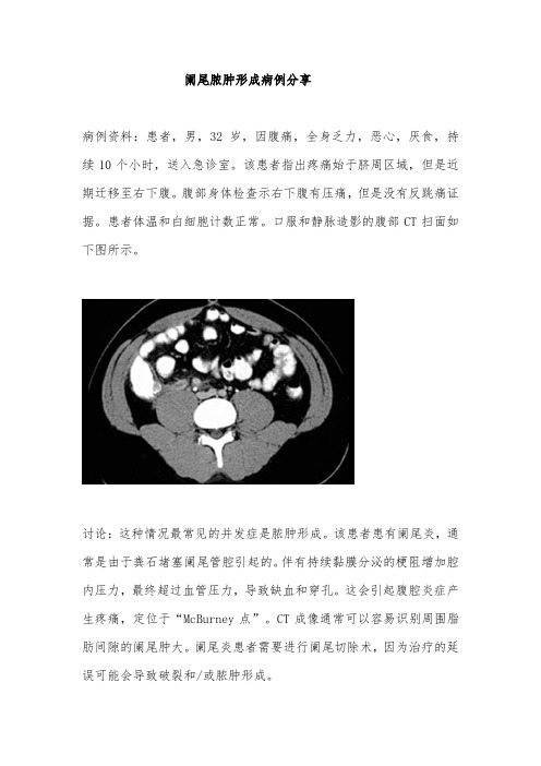 阑尾脓肿形成病例分享