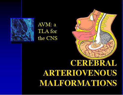 脑动静脉畸形(英文版)