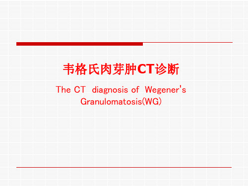韦格氏肉芽肿CT诊断