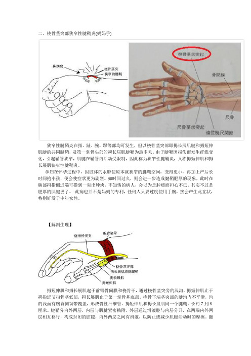 桡骨茎突部狭窄性腱鞘炎(妈妈手)