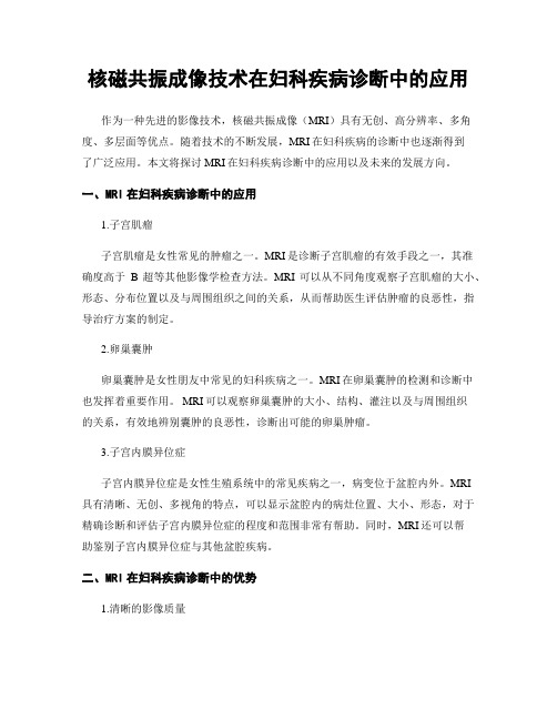 核磁共振成像技术在妇科疾病诊断中的应用