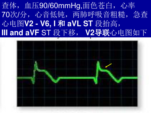 心血管病例讨论1PPT幻灯片