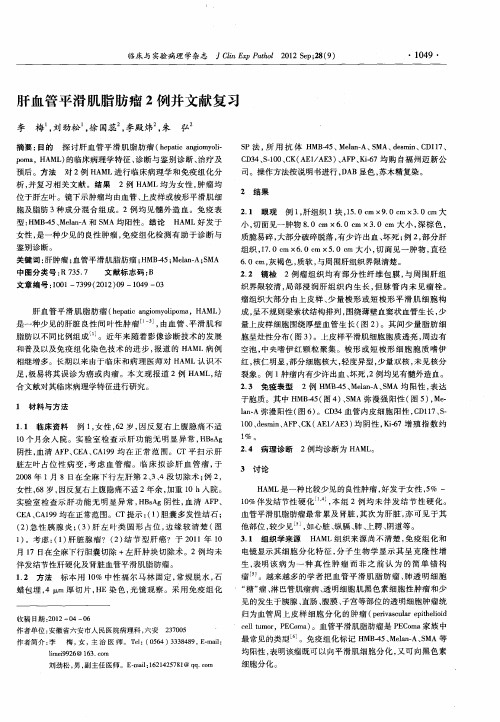 肝血管平滑肌脂肪瘤2例并文献复习