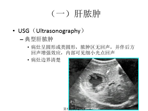 腹部疾病的诊断PPT课件