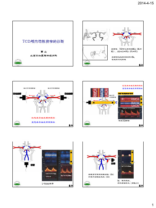 TCD对颅内动脉狭窄的诊断-20140118