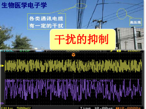 5-干扰的抑制方法解析