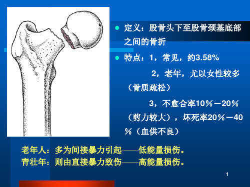 股骨颈骨折ppt_精品课件1