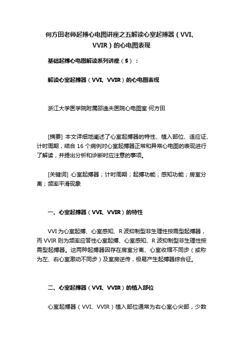 何方田老师起搏心电图讲座之五解读心室起搏器（VVI、VVIR）的心电图表现