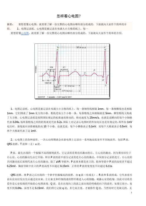 怎样看心电图