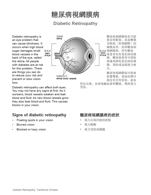 糖尿病视网膜病