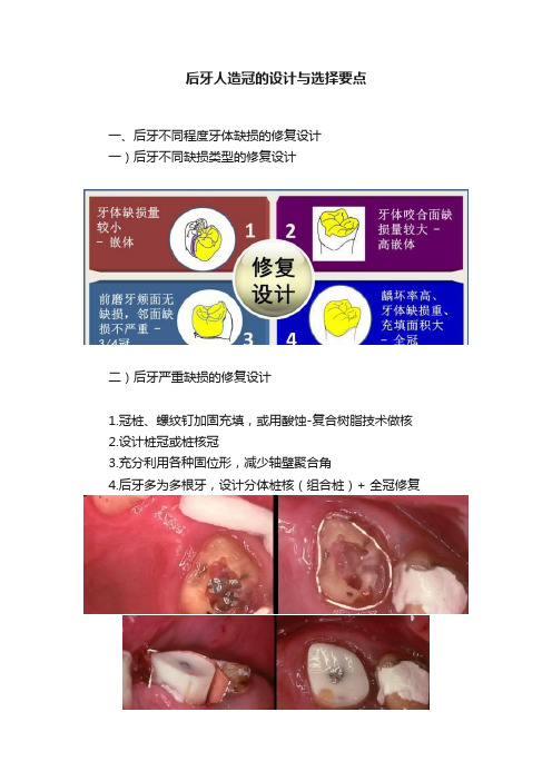 后牙人造冠的设计与选择要点