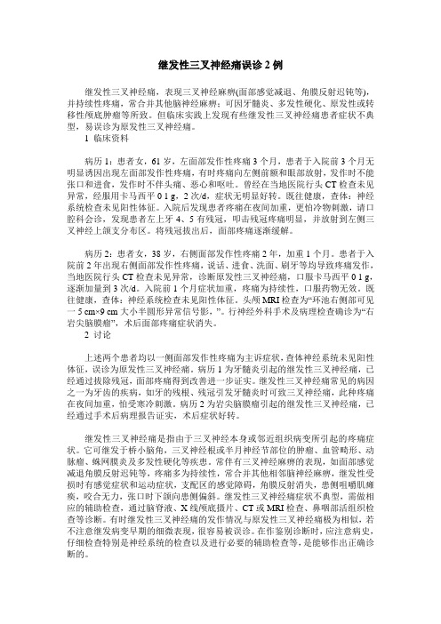 继发性三叉神经痛误诊2例