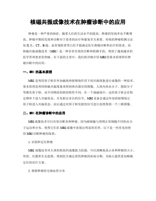 核磁共振成像技术在肿瘤诊断中的应用