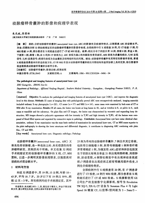 动脉瘤样骨囊肿的影像和病理学表现