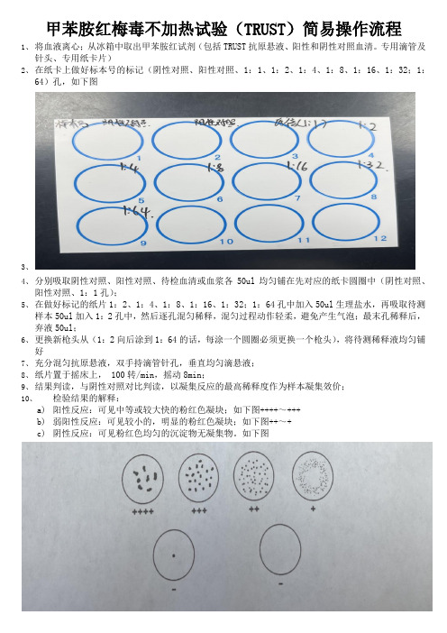 甲苯胺红梅毒不加热试验(TRUST)标准操作考核