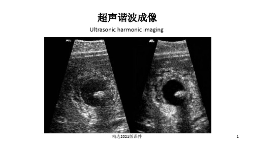 超声谐波成像ppt课件