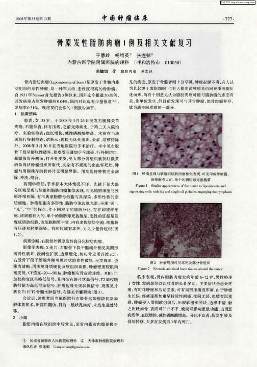 骨原发性脂肪肉瘤1例及相关文献复习