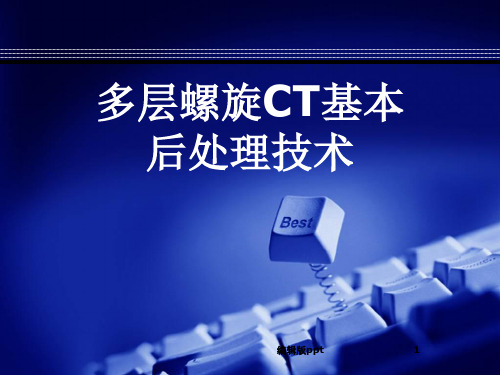 多层螺旋CT基本后处理技术ppt课件