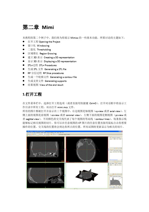 mimics中文版教程(持续更新版0812)