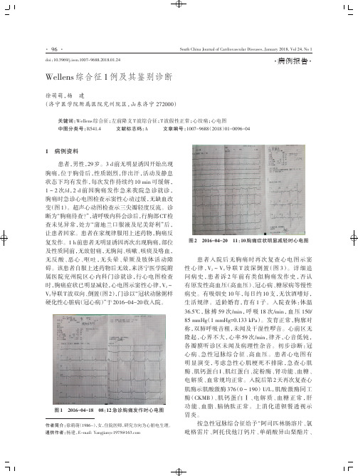 Wellens综合征1例及其鉴别诊断