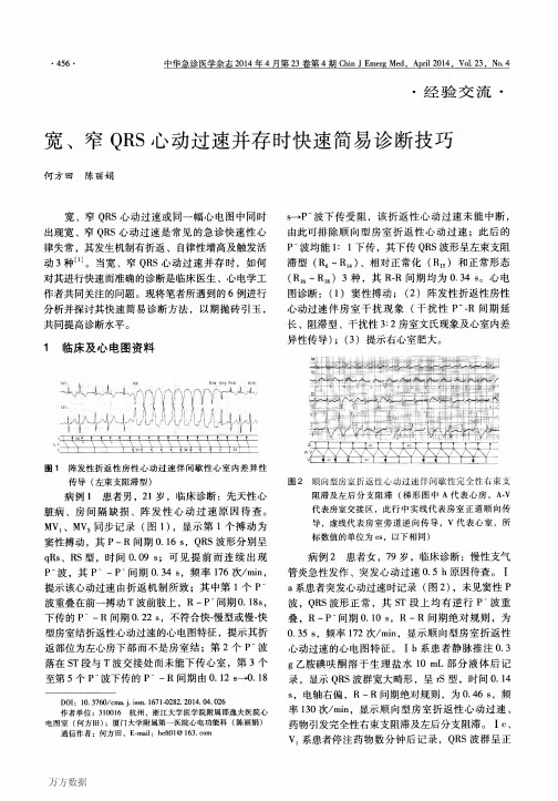 宽、窄QRS心动过速并存时快速简易诊断技巧