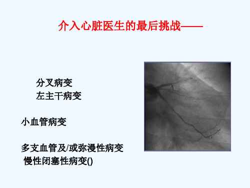 CTO病变治疗策略